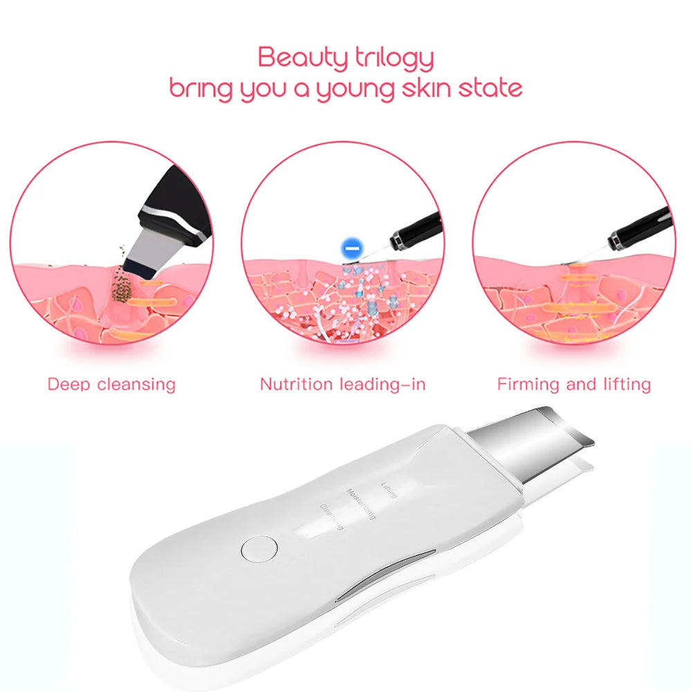 Ultrasonic Skin Scrubber Vibration Face Blackhead Remover